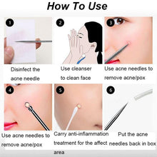 Load image into Gallery viewer, 4pcs Stainless Steel Acne Pimple Blackhead Remover Tools freeshipping - Tyche Ace