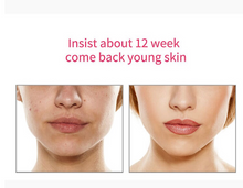 Load image into Gallery viewer, EMS  Warm and Cool LED Light Therapy Sonic Vibration Wrinkle Removal Skin Tightening Device freeshipping - Tyche Ace