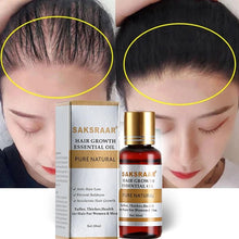 Load image into Gallery viewer, Essential Oils Original Authentic Liquid Hair Growth Serum freeshipping - Tyche Ace