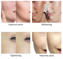 Load image into Gallery viewer, Facial Beauty 7 LED Colour Photodynamic Therapy Skin Care Home Use Masks freeshipping - Tyche Ace