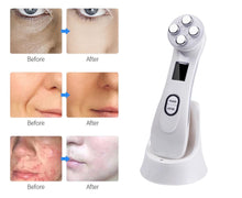 Load image into Gallery viewer, LED Photon Mesotherapy Electroporation RF Radio Frequency Face Lifting Wrinkle Reduction Massager freeshipping - Tyche Ace