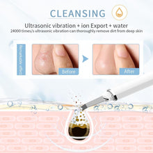 Load image into Gallery viewer, Thermal Care Heat Electric Ultrasonic Facial Scrubber Peeling Shovel Pore Cleaner freeshipping - Tyche Ace