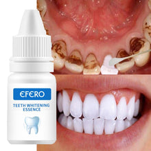 Load image into Gallery viewer, EFERO Teeth Whitening Essence Powder Clean Oral Hygiene Whiten Teeth Remove Plaque Stains Fresh Breath Oral Hygiene Dental Tools freeshipping - Tyche Ace
