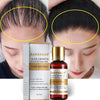 Essential Oils Original Authentic Liquid Hair Growth Serum freeshipping - Tyche Ace